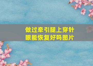 做过牵引腿上穿针眼能恢复好吗图片