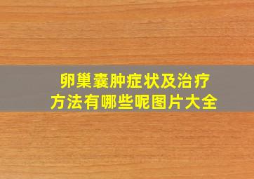 卵巢囊肿症状及治疗方法有哪些呢图片大全