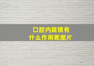 口腔内窥镜有什么作用呢图片