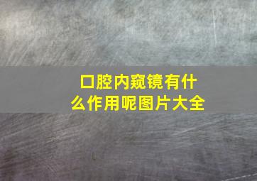 口腔内窥镜有什么作用呢图片大全