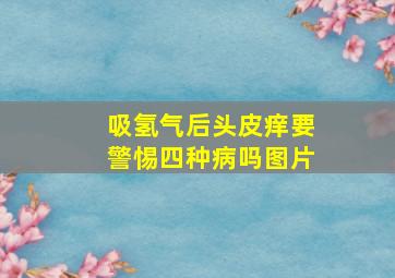 吸氢气后头皮痒要警惕四种病吗图片