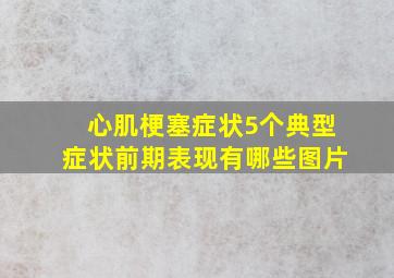 心肌梗塞症状5个典型症状前期表现有哪些图片