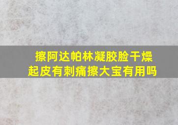 擦阿达帕林凝胶脸干燥起皮有刺痛擦大宝有用吗