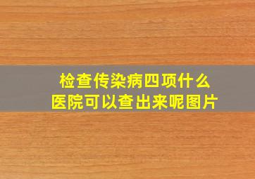 检查传染病四项什么医院可以查出来呢图片