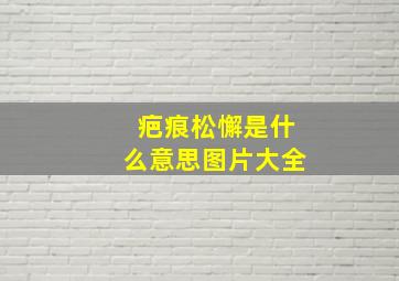 疤痕松懈是什么意思图片大全