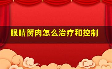 眼睛胬肉怎么治疗和控制