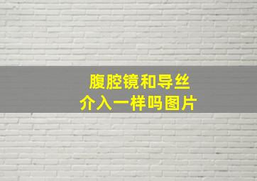 腹腔镜和导丝介入一样吗图片