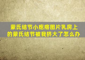 蒙氏结节小疙瘩图片乳房上的蒙氏结节被我挤大了怎么办