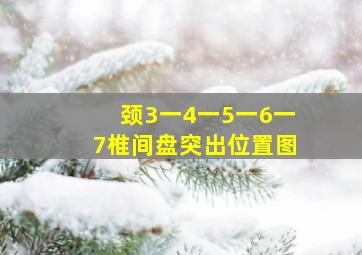 颈3一4一5一6一7椎间盘突出位置图